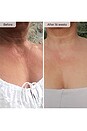 view 3 of 8 Neck & Decolletage LED System in 