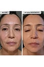 view 10 of 12 TRATAMENTO ANTIENVELHECIMENTO MICRO-INFUSION in 
