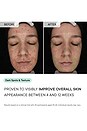 view 10 of 11 TRATAMENTO PARA MANCHAS ESCURAS MICRO-INFUSION in 