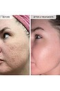 view 11 of 11 TRATAMENTO PARA MANCHAS ESCURAS MICRO-INFUSION in 