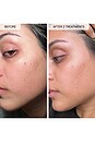 view 3 of 11 TRATAMENTO PARA MANCHAS ESCURAS MICRO-INFUSION in 