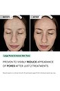 view 9 of 11 TRATAMENTO PARA MANCHAS ESCURAS MICRO-INFUSION in 