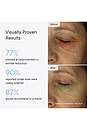 view 3 of 8 TRATAMENTO ANTIENVELHECIMENTO MICRO-INFUSION in 