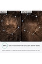view 7 of 10 Q-Renew LLLT Hair Growth Helmet in 
