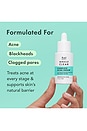 view 2 of 6 SÉRUM ANTI-ACNÉ MIRACLE CLEAR ACNE SERUM in 