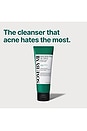 view 5 of 6 Aha Bha Pha 30 Days Miracle Acne Clear Foam in 