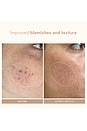 view 4 of 10 Retinol Reform Serum 10ml in 