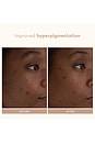view 5 of 10 Retinol Reform Serum 10ml in 
