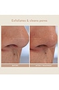 view 6 of 9 Triple Acid Signature Peel 8 Treatments in 