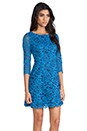 view 3 of 6 Celestial Lace Miranda Dress in Celestial Blue/Midnight in Celestial Blue & Midnight