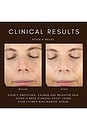 view 6 of 10 Star Flower Niacinamide Serum in 