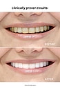 view 4 of 4 Travel Professional Extra Whitening System in 