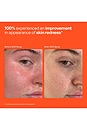 view 7 of 8 SOS Stressed Skin Starter Set in 