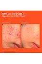 view 8 of 8 SOS Stressed Skin Starter Set in 