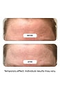 view 4 of 9 Mask Melt Blurring Overnight Hydrogel Mask 4pc. in 