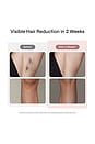 view 5 of 9 Air 10 IPL Laser Hair Removal Device in Pink