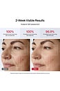 view 4 of 8 JMOON UCollagen+ Microcurrent + LED Light Therapy Device in Pink
