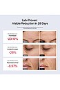 view 6 of 8 JMOON UCollagen+ Microcurrent + LED Light Therapy Device in Pink
