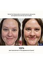 view 3 of 10 Skin Refine Gentle Pore Clearing Serum in 