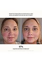 view 4 of 10 Skin Refine Gentle Pore Clearing Serum in 