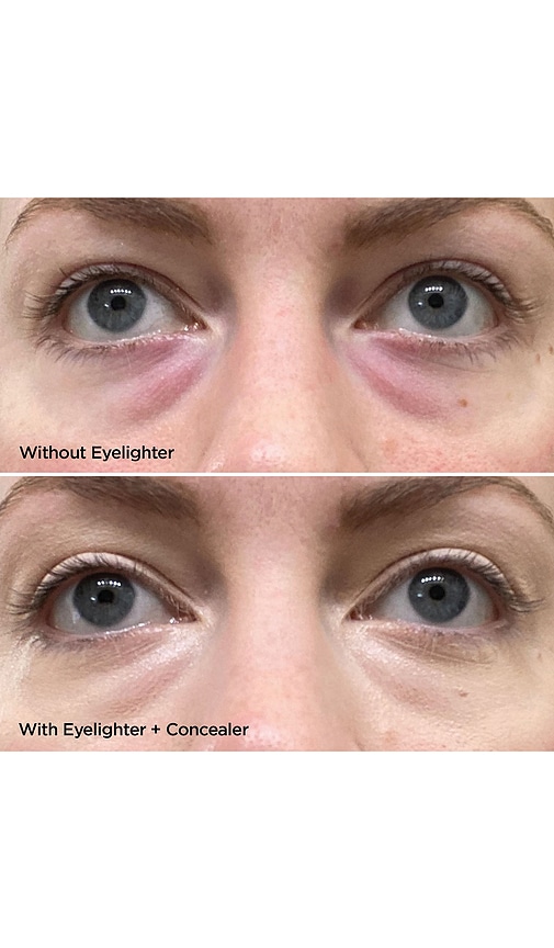  Beautybio The Eyelighter Concentrate In Beauty: Na. 
