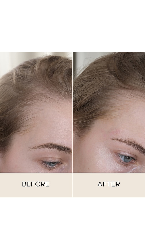  Christophe Robin Suero Del Cuero Cabelludo Fortifying Scalp Serum With Amaranth Peptides En Color Belleza: Na Talla All . 