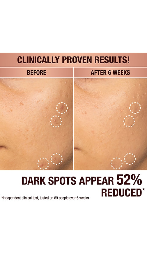Dark Spot Correcting Radiance Recovery Serum 30ml | Image | 1