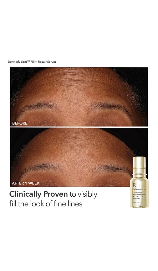 Dr Dennis Gross Skincare Fill, Plump, & Firm Set