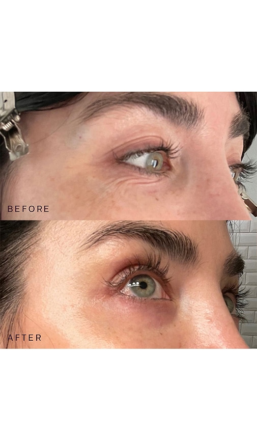 DERMACLARA OCCLUSION EYES & MOUTH PATCHES 
