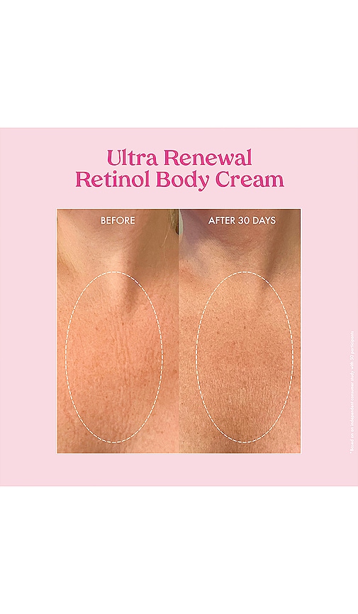 Shop Kopari Ultra Renewal Retinol Body Cream In Beauty: Na