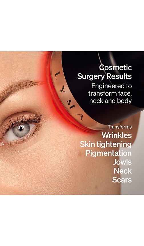 Lyma Laser Pro Starter Kit In Beauty: Na. 