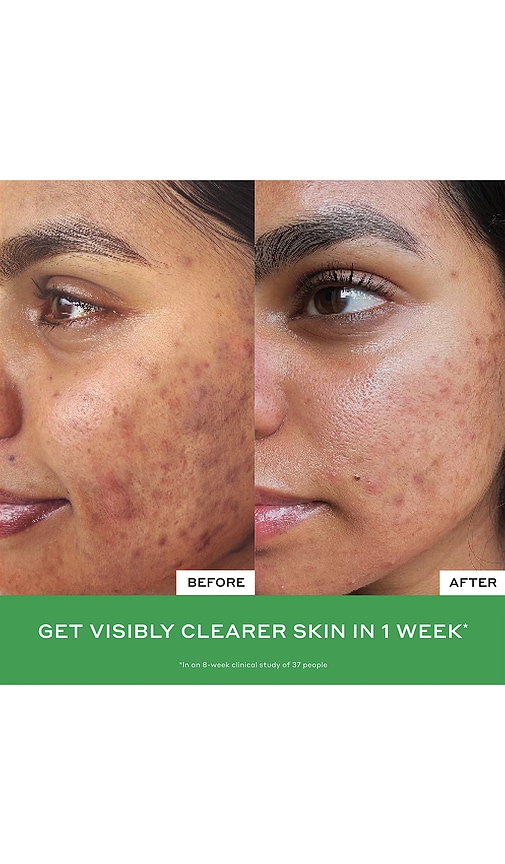 Olehenriksen Daily D-clog Pore-clearing Cleanser In Transparent