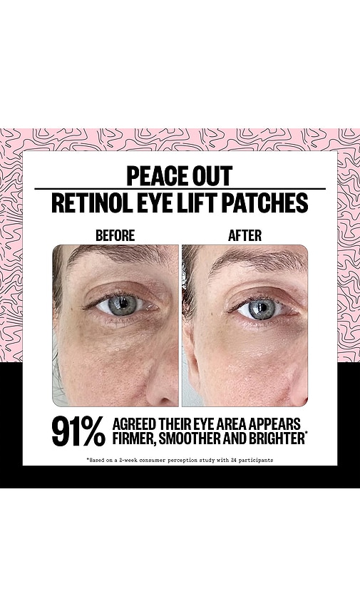 Peace Out Retinol 360? Eye Lift Patches To Lift, Firm And Revitalize Eyes