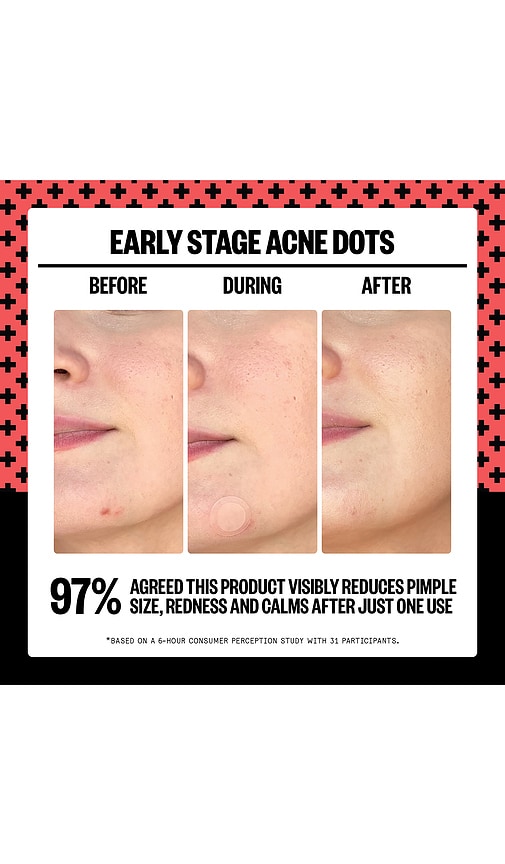 Peace Out 2% Salicylic Acid Early Stage Acne Dot 8 Dots