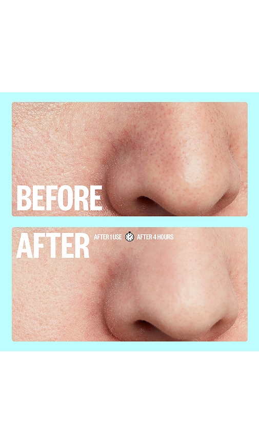 Peace Out Oil-absorbing Pore Treatment Strips