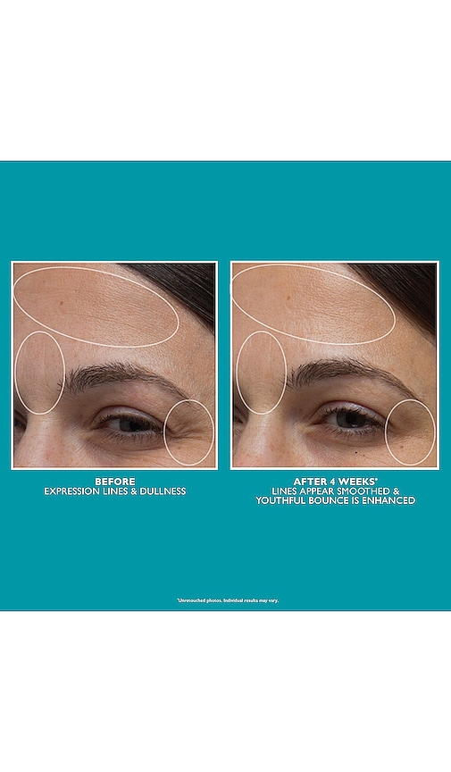  Peter Thomas Roth Crema Peptide Skinjection Moisture Infusion Cream En Color Belleza: Na Talla All . 