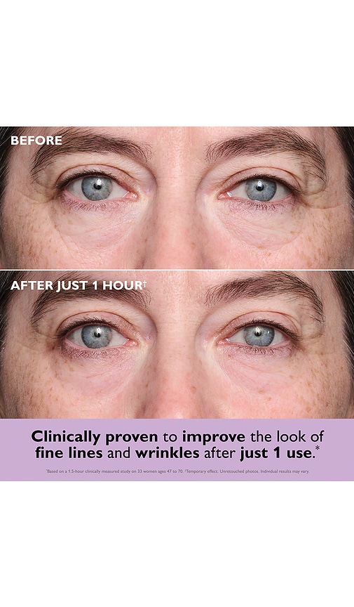 Peter Thomas Roth Instant Firmx Collagen-infusion Tightening Eye Patches