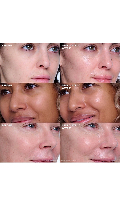  Peter Thomas Roth Suero Collagen Skinjection Plumping & Firming Serum En Color Belleza: Na Talla All . 