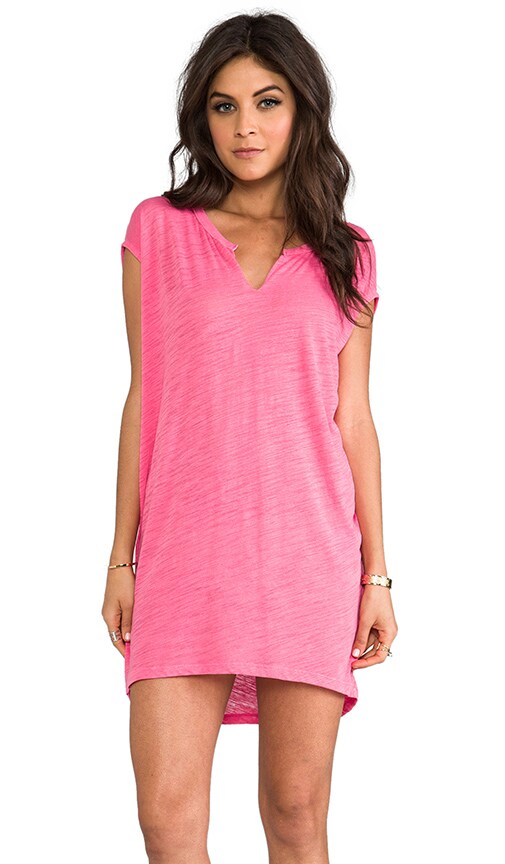 Tunic Dress