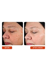 Universal C Skin Refiner - thumbnail 8
