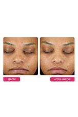 Universal Triple Action Daily Peel 10 Pack - thumbnail 8