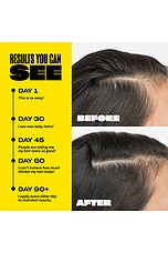 Densifying Hair Serum - thumbnail 6