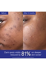 Vinoperfect Dark Spot Serum 50ml - thumbnail 6