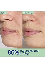 Vinopure Pore Minimizing Serum - thumbnail 5