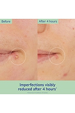 Vinopure Salicylic Spot Solution - thumbnail 7