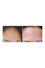 AHA/BHA Clarifying Treatment Toner - thumbnail 9