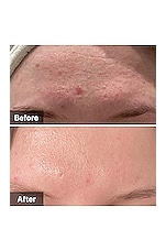 Advanced Snail 96 Mucin Power Essence - thumbnail 8