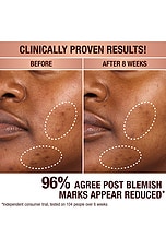 Dark Spot Correcting Radiance Recovery Serum 10ml - thumbnail 8