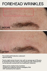 InstaFacial Plasma Bioactive Growth Factor Serum 30ml - thumbnail 9