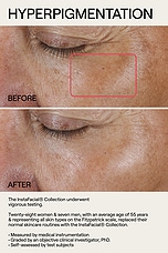 Instafacial Plasma Bioactive Growth Factor Serum 15ml - thumbnail 8